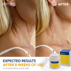 ElySeoul cream for sagging neck skin lifestyle shot