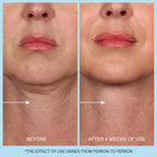 Ujhay 3-in-1 face neck and chest firming cream