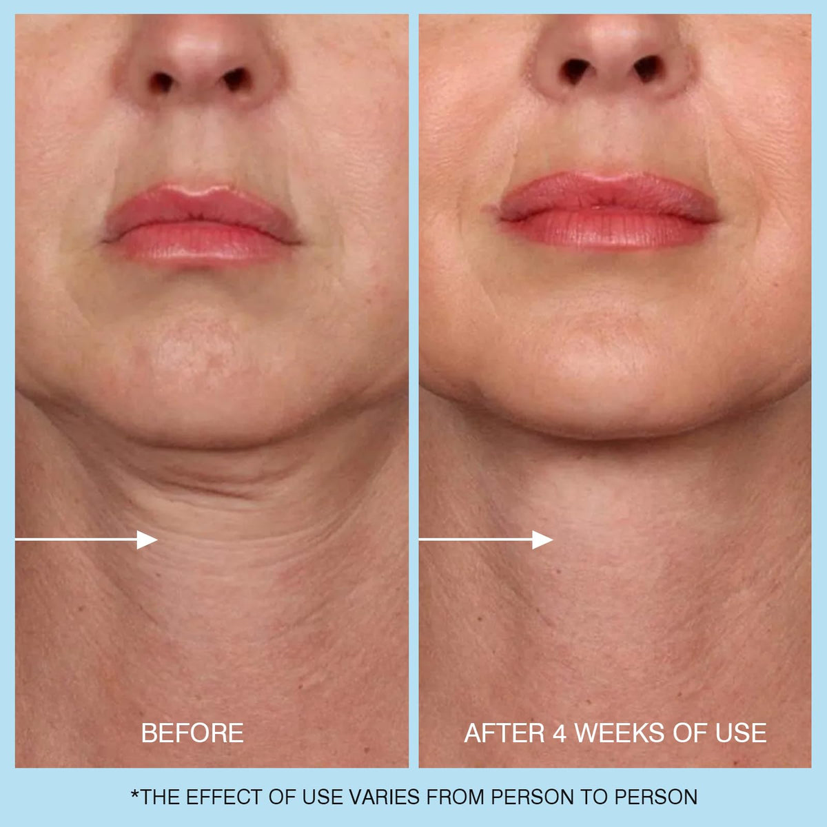 Ujhay 3-in-1 face neck and chest firming cream