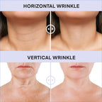 Derphea skincare product label showing ingredients and benefits