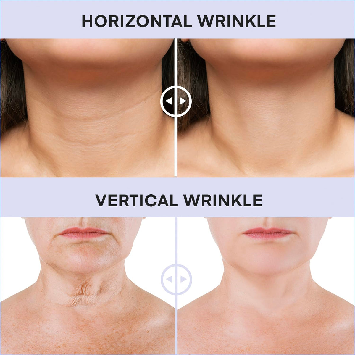 Derphea skincare product label showing ingredients and benefits