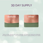 Silc Skin chest wrinkle treatment packaging front view