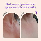 Blumbody reusable silicone chest patches application demonstration