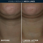 RoC neck cream packaging showcasing advanced retinol and hyaluronic acid