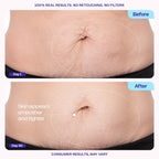 GOPURE firming belly cream packaging displaying the 6 percent MicroTight4 complex details