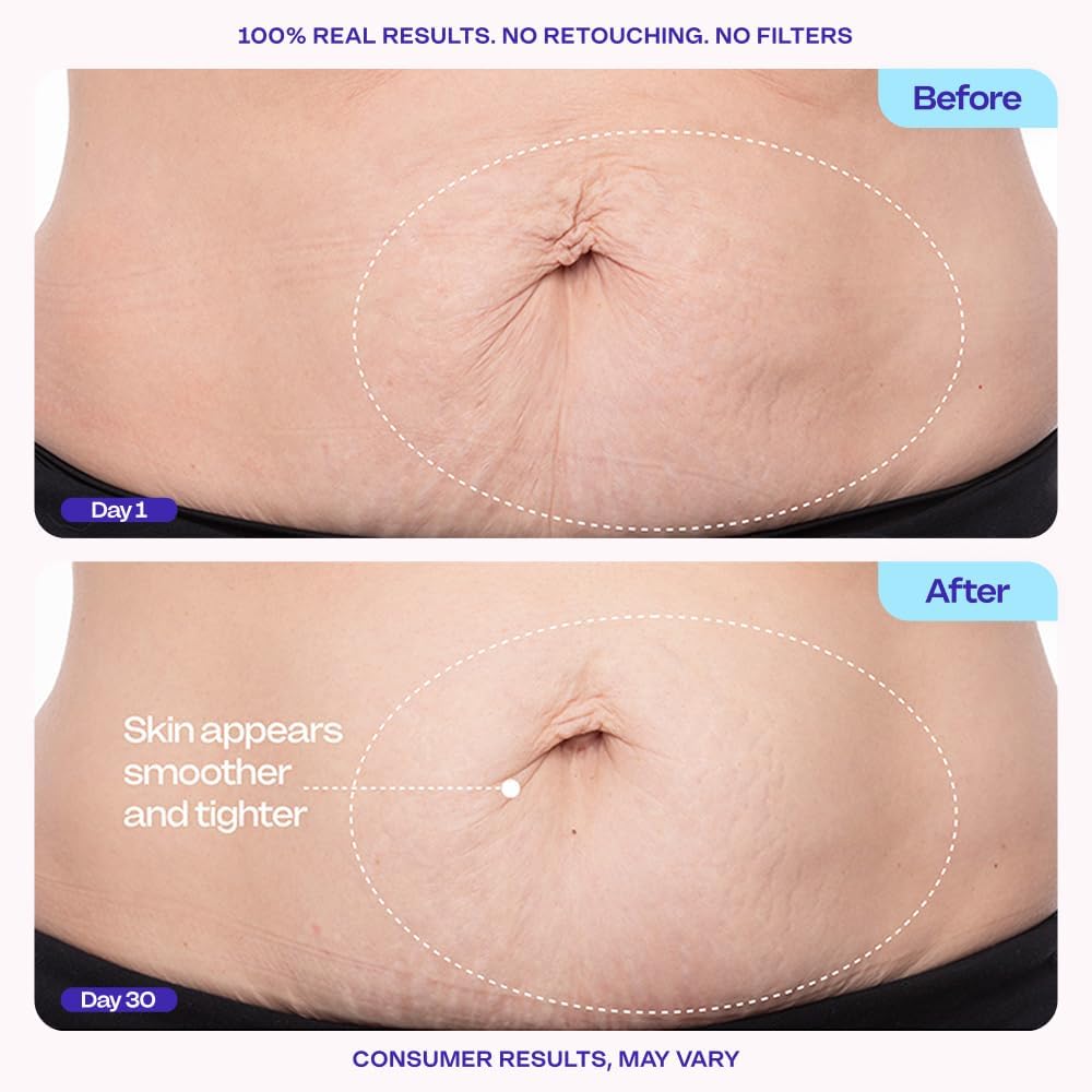 GOPURE firming belly cream packaging displaying the 6 percent MicroTight4 complex details