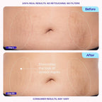 GOPURE stretch mark reduction moisturizer container on a clean background for body care routines