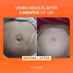 Cicatrissim innovative stretch mark cream natural formula back label and ingredients