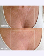 Back view of the reusable medical grade silicone patch with adhesive layer.