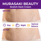 Murasaki Beauty maternity cream for stretch marks removal jar on a clean background.