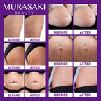 Nourishing formula stretch mark cream highlighting ingredients like hyaluronic acid and peptides.