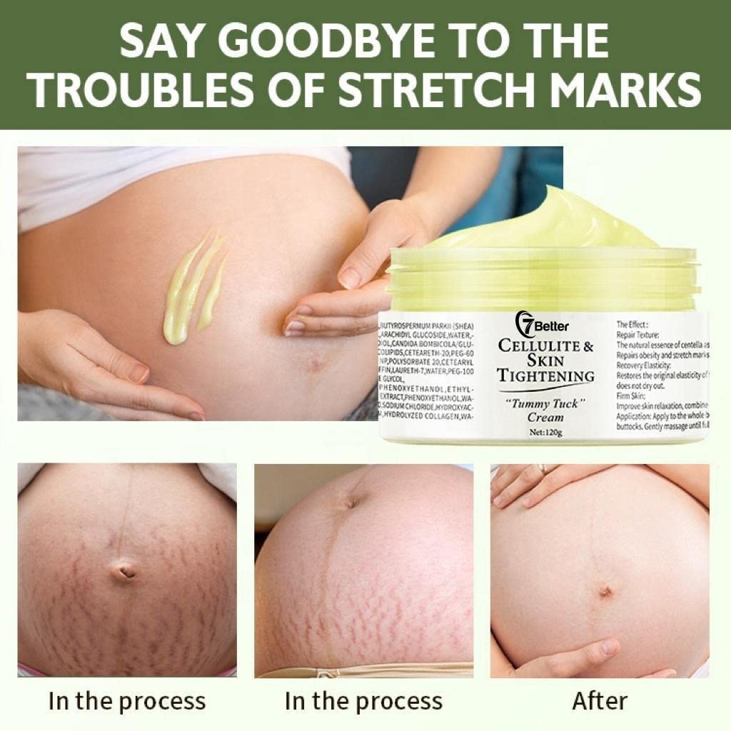 7better LLC postpartum skin tightening cream for cellulite reduction on thighs and hips