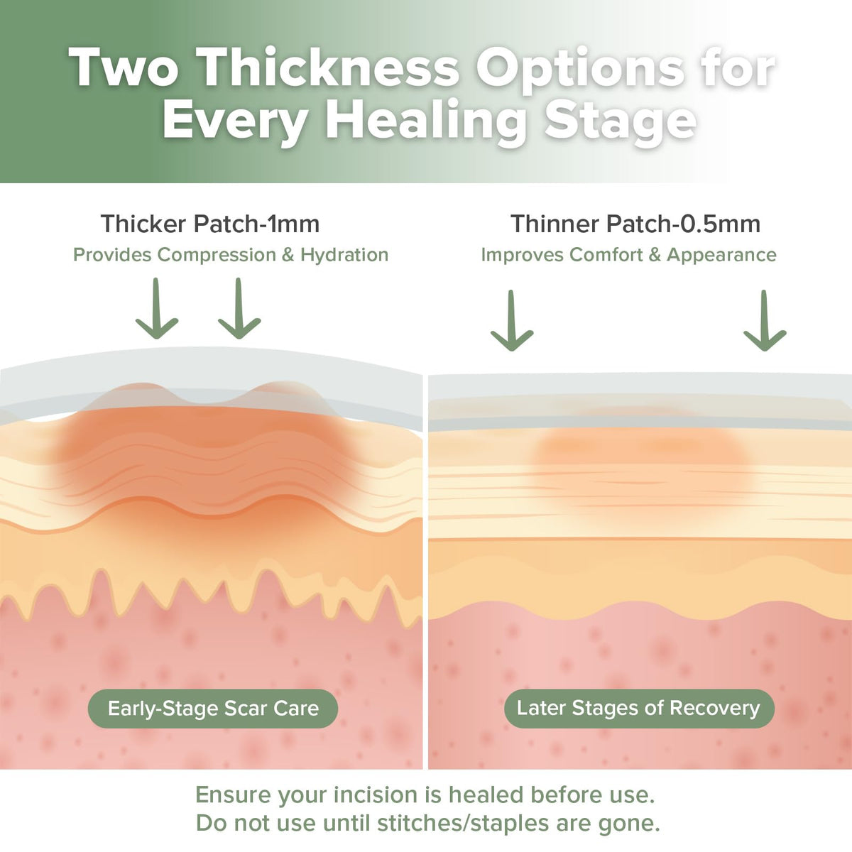 Demonstration of the thin and thick reusable sheets designed for day and night scar management