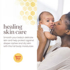 Pediatrician tested Burt's Bees Baby natural origin multipurpose healing ointment side view highlighting benefits