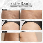 Imported USA stretch mark removal cream stick marker format