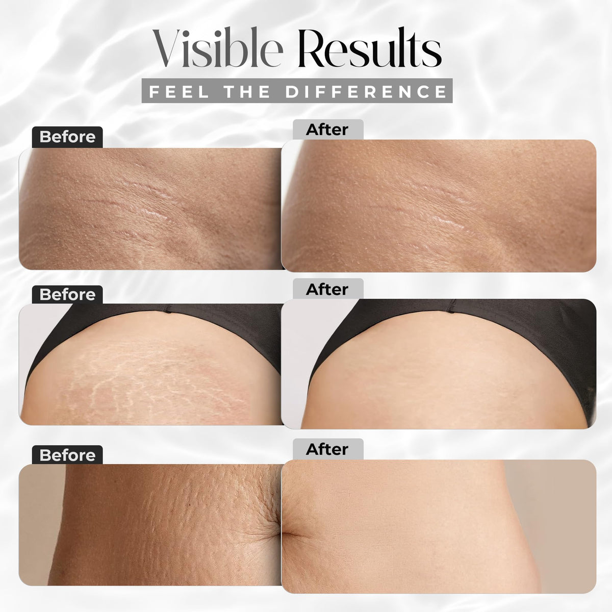Imported USA stretch mark removal cream stick marker format