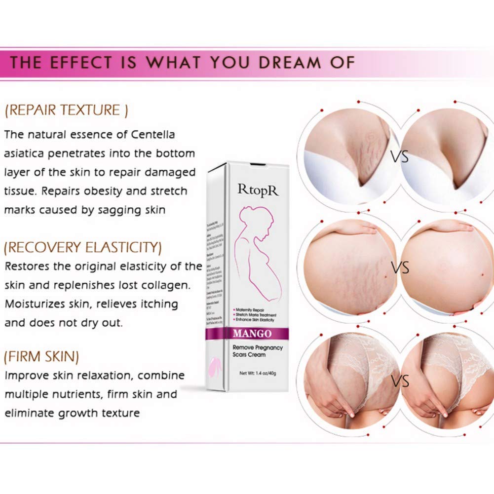 Botanical skin elasticity cream for fading postpartum stretch marks