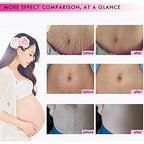 Side view of non greasy fast absorbing pregnancy scar cream