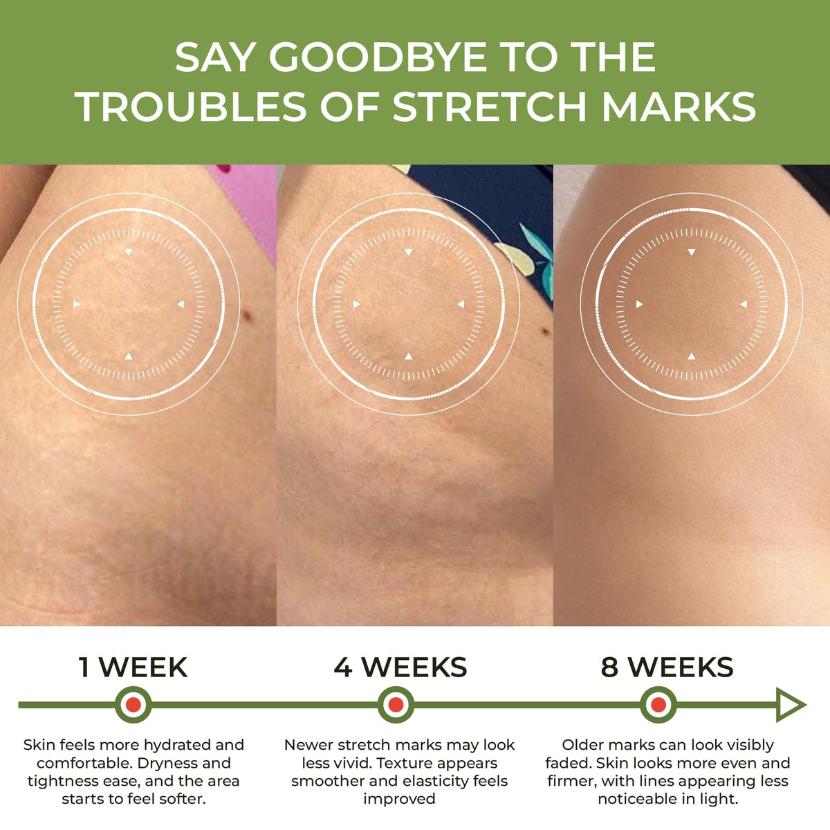 Maternity stretch mark cream by Abera for safe prenatal body care