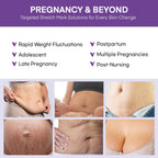 Authentic USA imported belly butter cream for prenatal and postnatal intensive skin repair