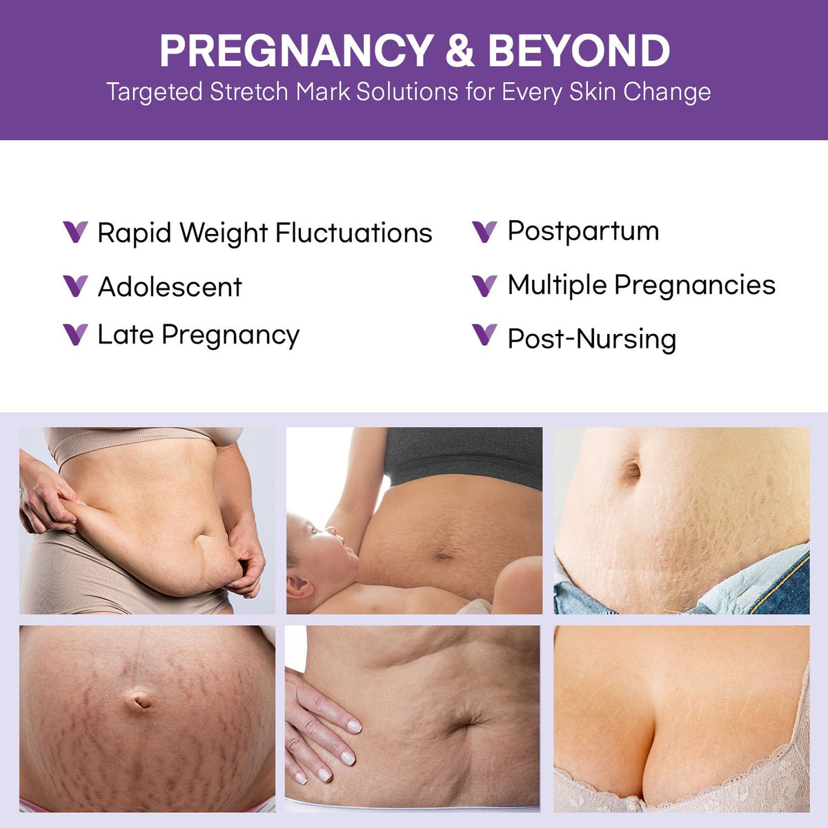 Authentic USA imported belly butter cream for prenatal and postnatal intensive skin repair