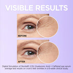 L'Oreal Paris Revitalift eye serum clinical results visual
