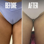 Divine Derriere salicylic and glycolic acid treatment pads for preventing pseudofolliculitis barbae