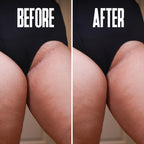 Divine Derriere skin smoothing solution for men and women suffering from razor bumps