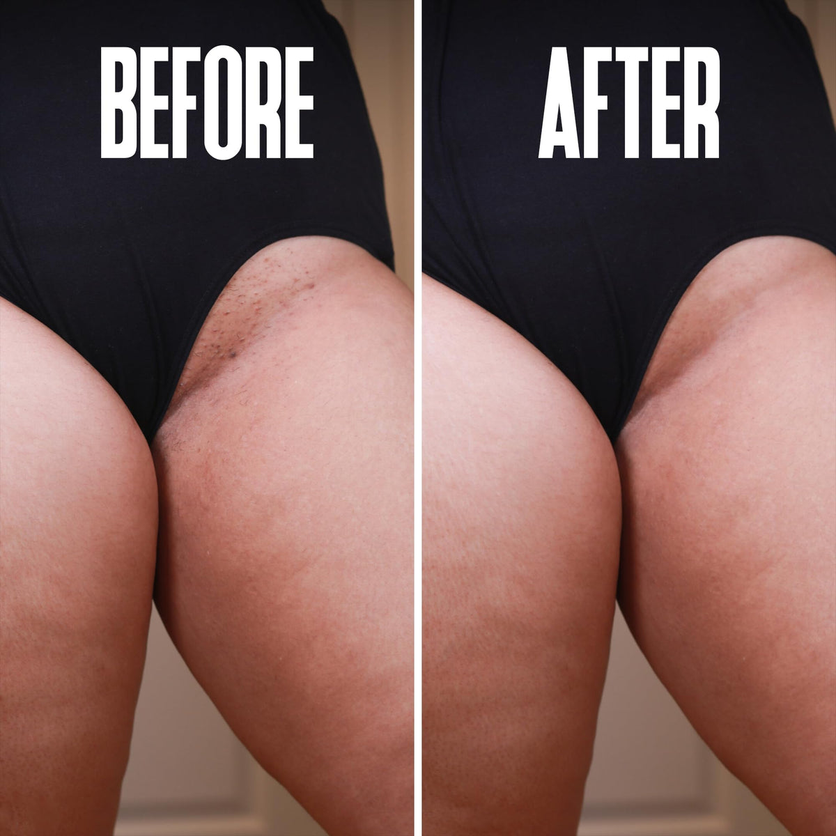 Divine Derriere skin smoothing solution for men and women suffering from razor bumps