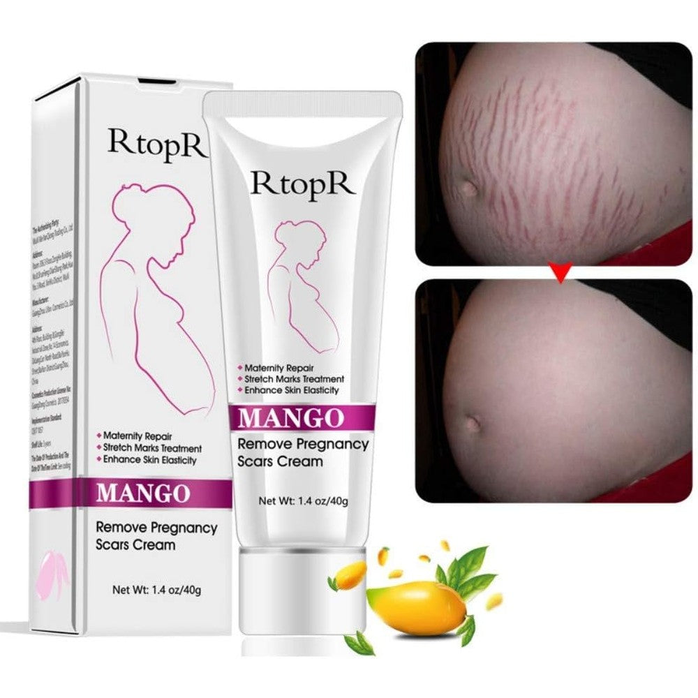 Dr Jon YG LianKai Mango Stretch Marks and Scar Removal Cream front view package