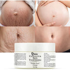7better LLC Postpartum Elegance stretch mark removal cream front view for pregnancy skincare